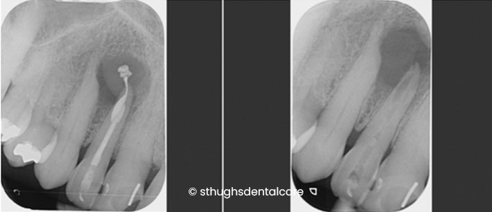 Case 1
