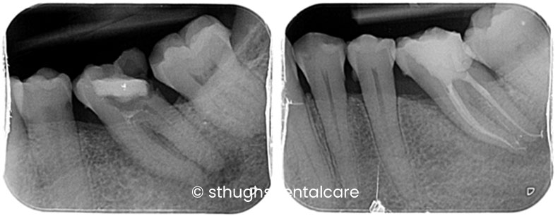 Case 10