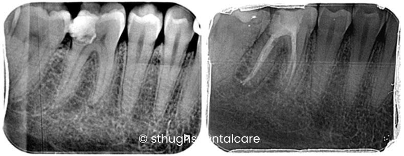 Case 11