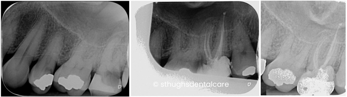 Case 14
