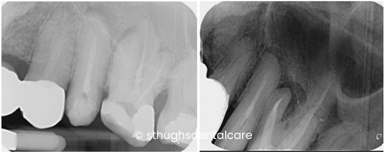Case 15