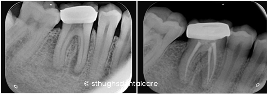 Case 16