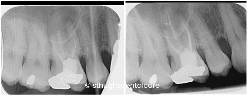 Case 17