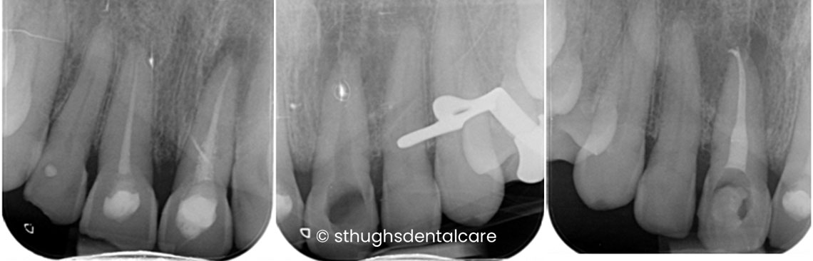 Case 18