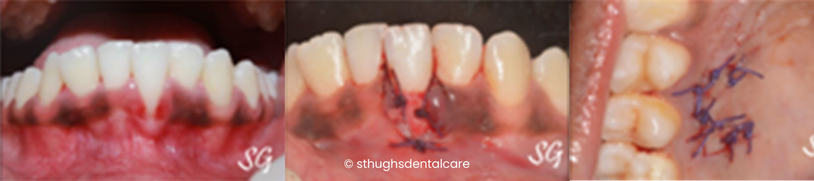Case 26