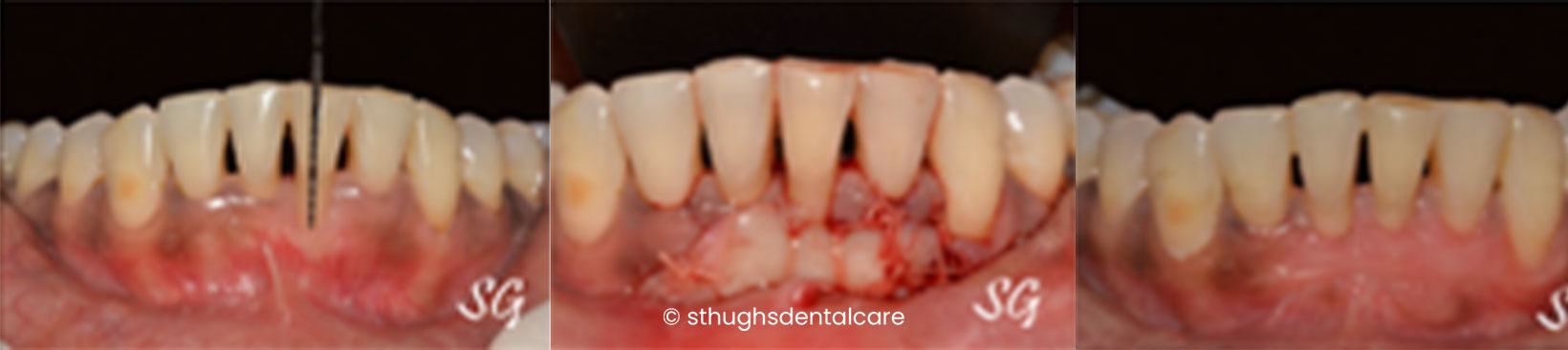 Case 27