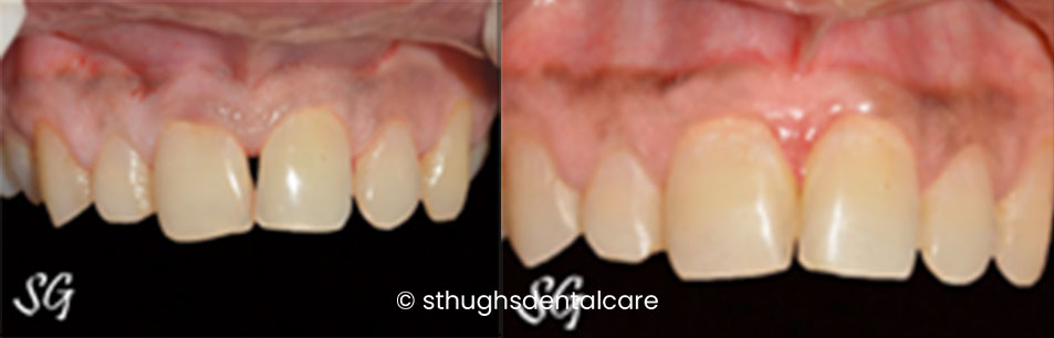 Case 28