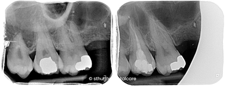 Case 4