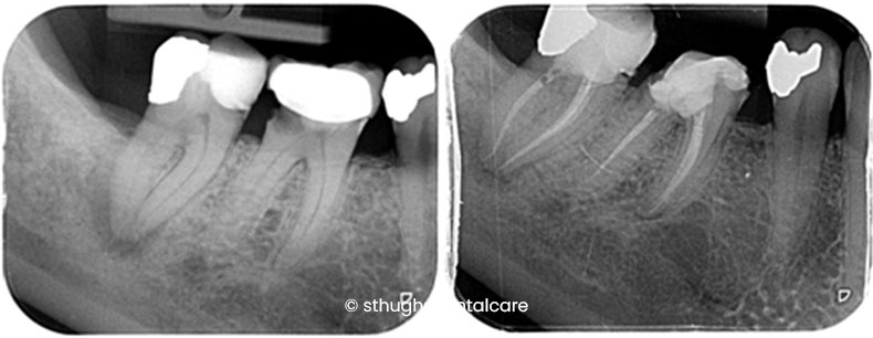 Case 5