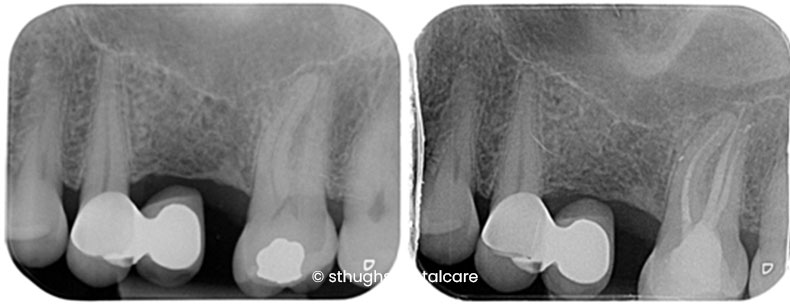 Case 6