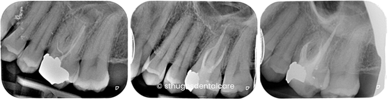 Case 8